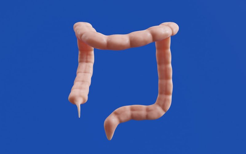 The image shows a 3D model of a colon.